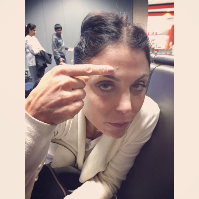 Bethenny Frankel, Acne